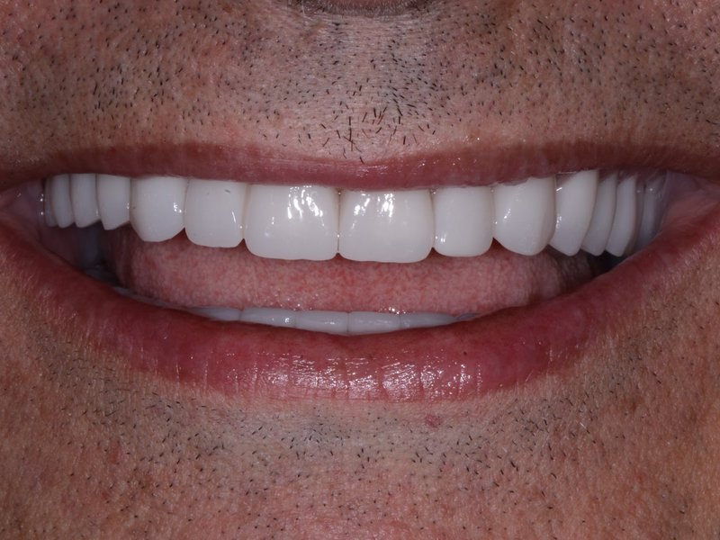 Hamoudi's smile after treatment