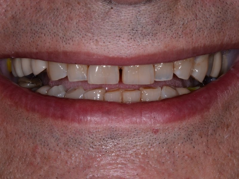 Hamoudi's smile before treatment